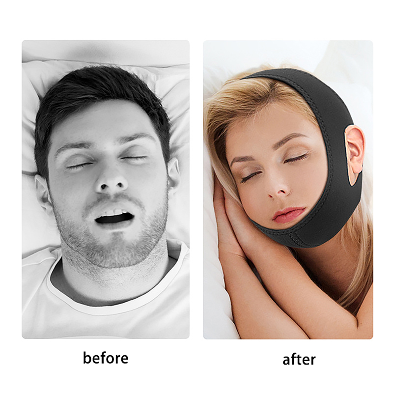 Anti Snore Chin Strap Adjustable - Adjustable New Neoprene Anti Snoring Strap