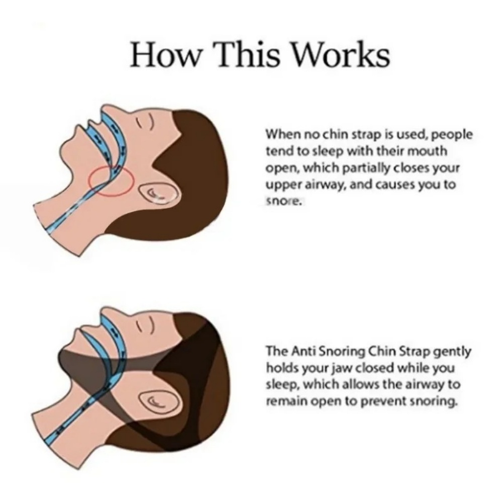 Breathable Adjustable Anti Sno - Anti Snore Chin Strap Adjustable ulasan dan harga